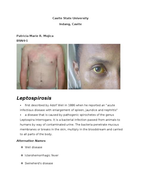 Leptospirosis Print Pdf Epidemiology Microbiology