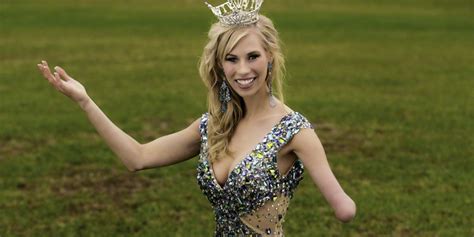 Meet Miss Iowa The Beauty Queen Without A Left Forearm Raising