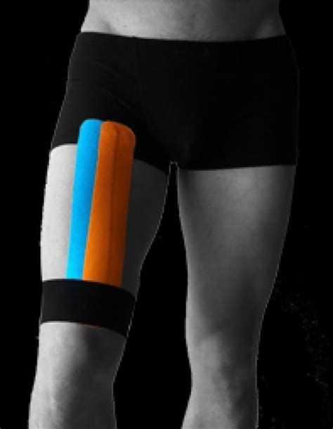 Ares Kinesiology Tape Front Thigh 1 Quadriceps Lowerbackpain