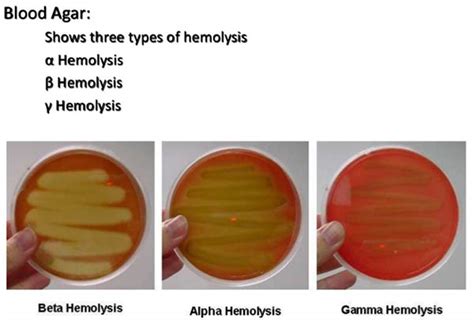 Hemolysis Types Microbiology Laboratory Turkey