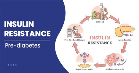 What Is Insulin Resistance