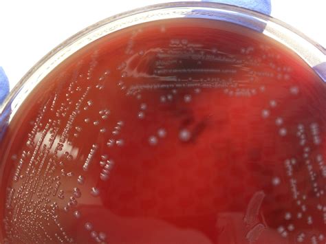 Como Se Pega A Bactéria Enterococcus Faecalis
