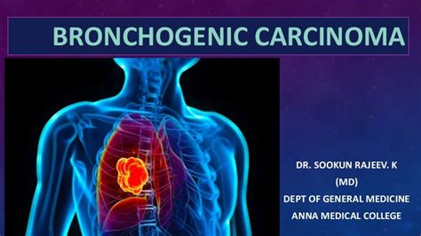 Bronchogenic Carcinoma By Dr Sookun Rajeev Kumar