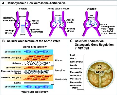 Calcific Aortic Valve Disease Not Simply A Degenerative Process