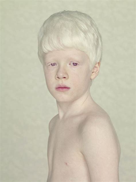 1000 Images About Albino Beauty On Pinterest Tanzania Eyelashes And