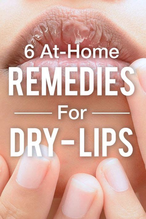 From Honey To Rose Petals Here Are 6 At Home Remedies To Soothe Dry