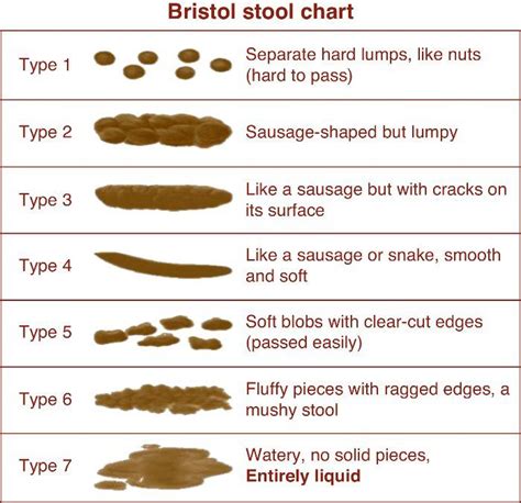 Bristol Stool Chart Miracles Of Health