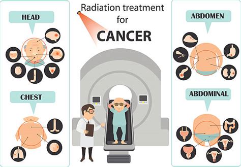 Radiation Therapy Chemotherapy Clipart All About Radiation