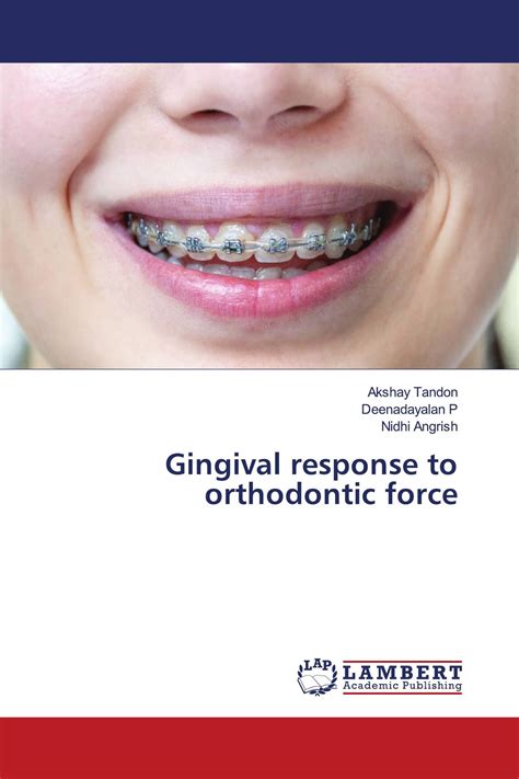 Gingival Response To Orthodontic Force 978 620 5 49283 3