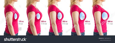 Breast Implant Size Over Royalty Free Licensable Stock Photos