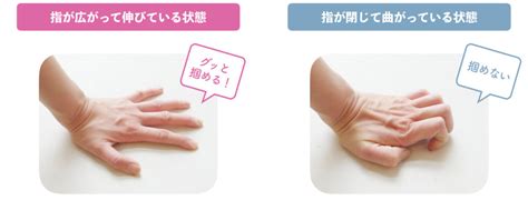 Ni naru and ni suru (になる and にする). 第2話｜関節リウマチによる膝痛ではなく、小指の「浮指」が ...