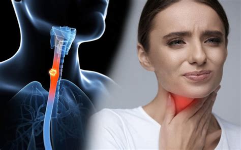 6 of the most common symptoms of throat cancer that you shouldn t ignore health advice