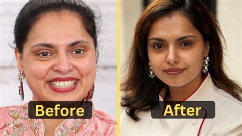 Maneet Chauhan S Weight Loss Diet Plan Workout Surgery Before And After Beautiful You