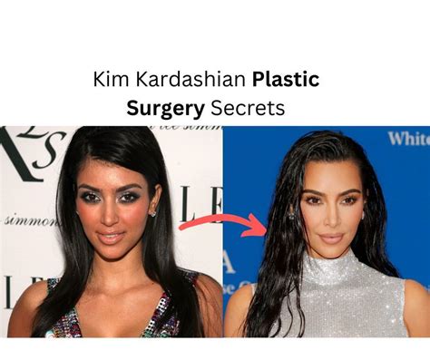 Kim Kardashian Plastic Surgery Secrets 2023 Fabbon