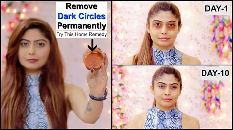 Remove Dark Circles Permanently In 10 Days Home Remedy Youtube