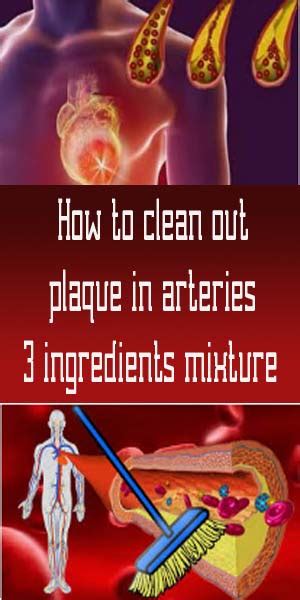 how to clean out plaque in arteries 3 ingredients mixture healthy