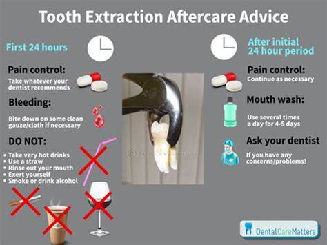Painful wisdom teeth can occur for a number of reasons. Tooth extraction aftercare advice | Tooth extraction ...