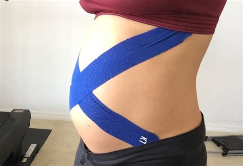 Kinesio Taping During Pregnancy Techniques For The Pregnant Belly
