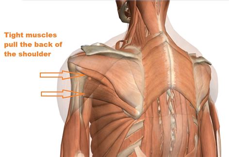 Shoulder Tendon Anatomy Shoulder Mri Radiographical