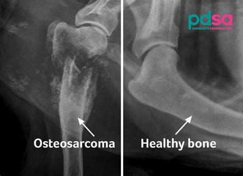 Osteosarcoma Bone Cancer In Dogs Pdsa