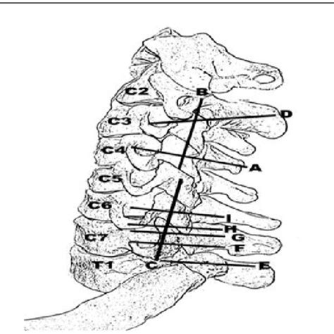 transverse scan of the upper cervical spine at the level of the c2 c3 download scientific