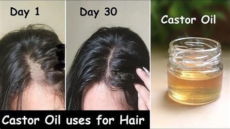Castor Hair Oil To Get Thick Hair In 30 Days Double Hair Growth