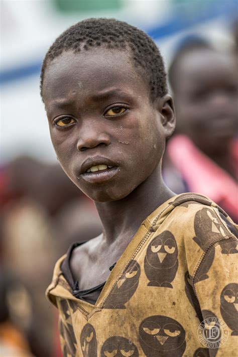 Pheomelanin causes reddish hair and the rusty look of most freckles. Why do so many black african people have yellow eyes ...