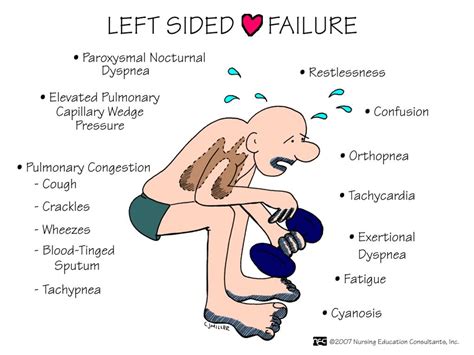 Left Sided Heart Failure Biology Forums Gallery