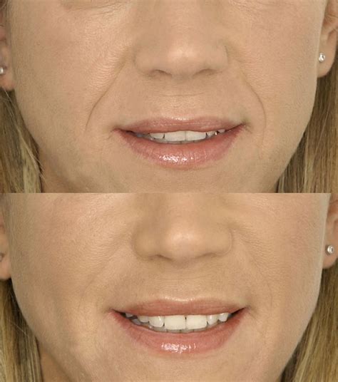 Orthodontics Improves Facial Beauty Moira Wong Orthodontics
