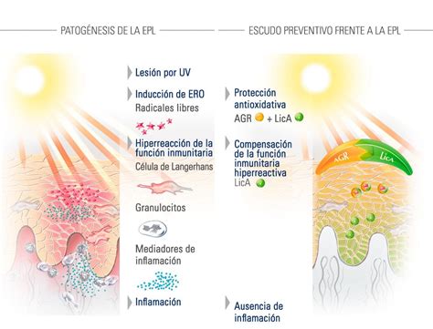 Alergias Solares Síntomas Y Causas Acerca De La Piel Eucerin