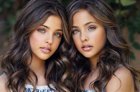 The Most Beautiful Twins In The World Their Life Many Years After