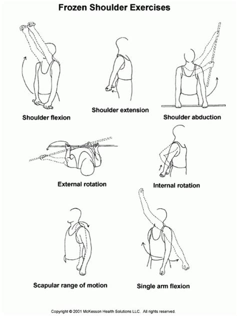 Exclusive Physiotherapy Guide For Physiotherapists Exercise For Frozen