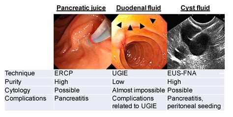 Diagnostics Free Full Text Early Detection Of Pancreatic Cancer
