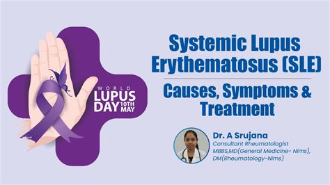 Systemic Lupus Erythematosus Sle Causes Symptoms And Treatment