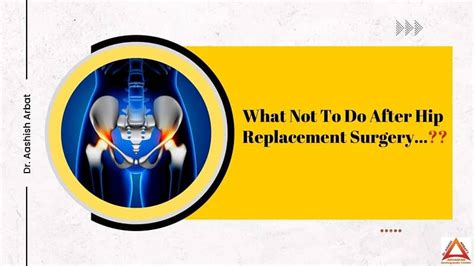 What Not To Do After Hip Replacement Surgery Best Joint Replacement