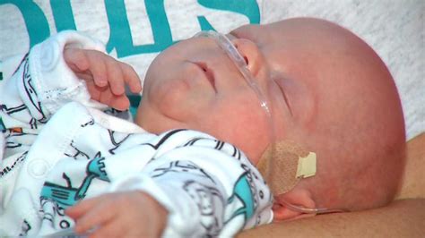 Polk Co Premature Baby Born At 24 Weeks Home At Last