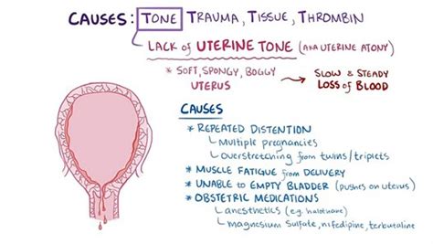 Postpartum Hemorrhage Causes Symptoms Treatment Pathology Video Dailymotion