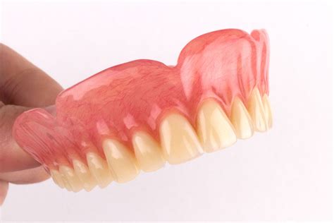 Chrome Dentures Chrome Denture Design Dental Laboratory