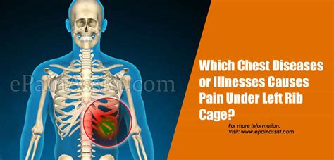 Rib Cage Pain Why Do I Have Pain Under My Right Rib Cage Yourmd