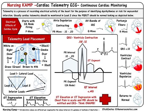 Cardiac Telemetry ECG TWS Nursing Babe Studying Nursing Babe Notes Nursing Study