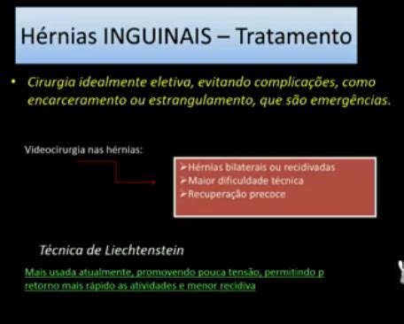 R bergrønningen, alvdal sist oppdatert: Resumidão Med: Cirurgia Geral