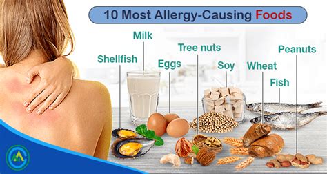 Common Causes And Treatments Of Food Allergies Life Bridge Health And Fitness