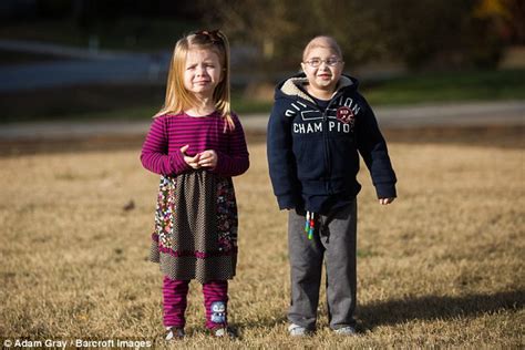Boy Suffers From Dwarfism That Affects Less Than 30 People Daily Mail