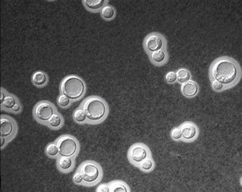 Cryptococcus Neoformans Morphology