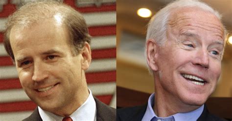 exhales serenely joe biden is officially in the white house. Botox, hair plugs, and veneers: Biden could escape the ...