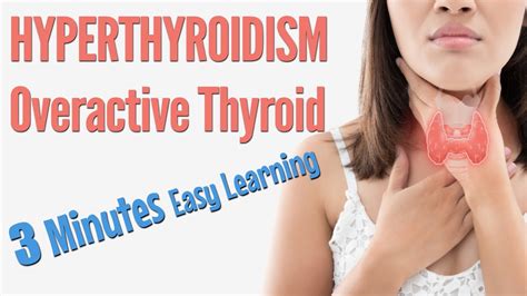 Hyperthyroidism Overactive Thyroid Causes Symptoms Risk Factor Treatment Minutes