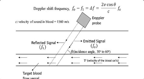 How are scores on the ultrasound board exams related to study time? Schematic of Doppler ultrasound principle | Download ...