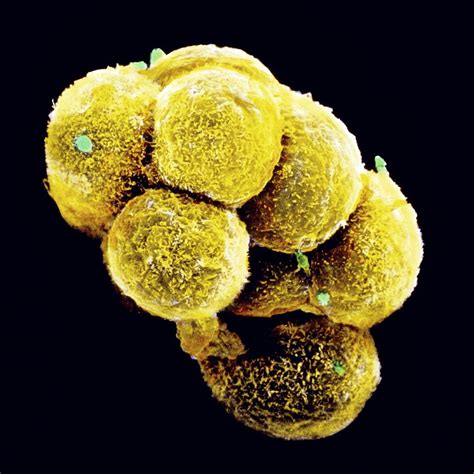 Coloured Sem Of An Embryo At The Stage Of Morula Photograph By