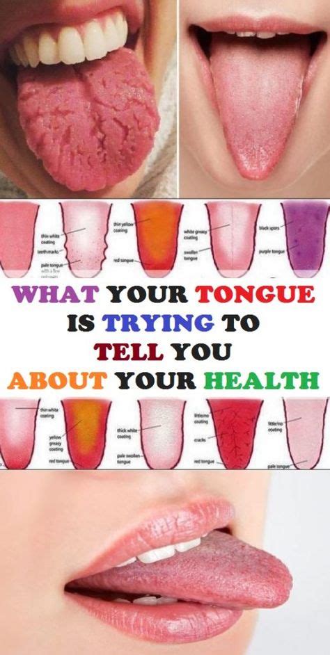 What Your Tongue Is Trying To Tell You About Your Health Health Remedies