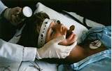 Electrical Convulsive Therapy Pictures